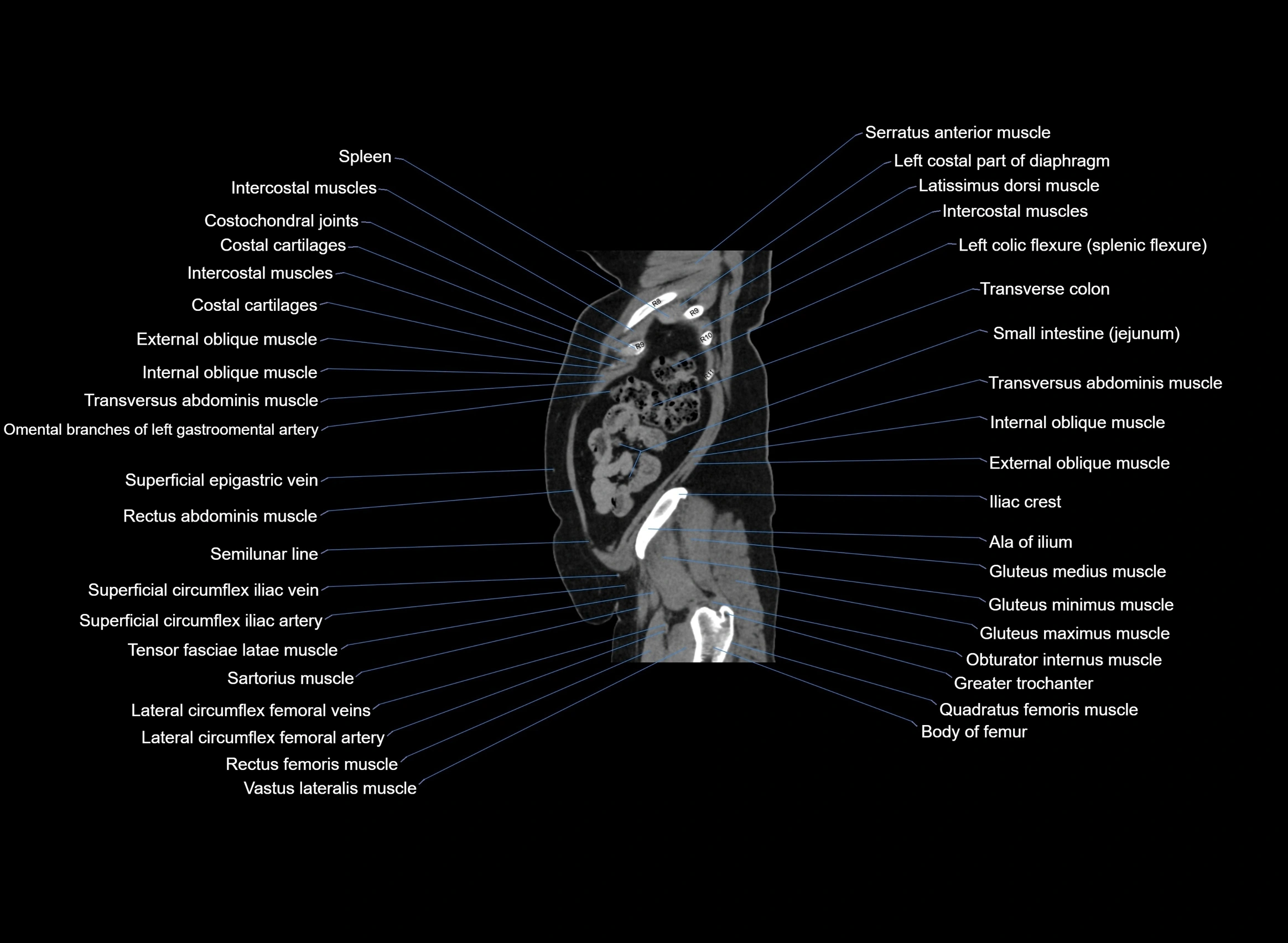 CT Abdomen sagittal cross sectional anatomy labelled radiology image -00017.webp